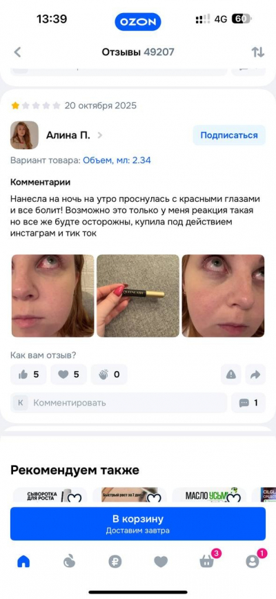 Чем может обернуться использование «безобидной» сыворотки для роста ресниц Queenlash? Берегите себя.